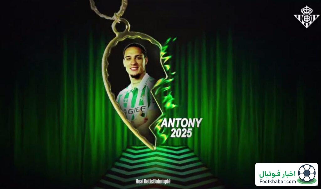 رونمایی دیوید لینچی بتیس از آنتونی (عکس)‏