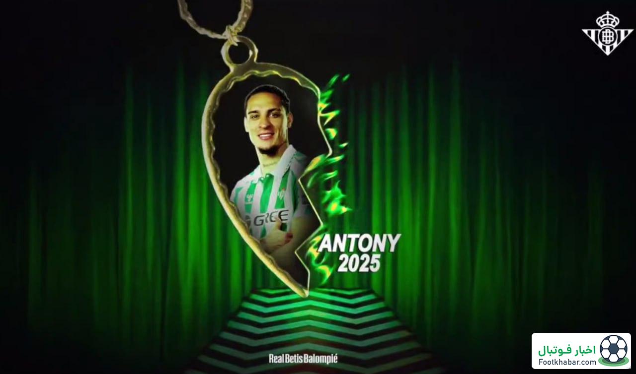 رونمایی دیوید لینچی بتیس از آنتونی (عکس)‏