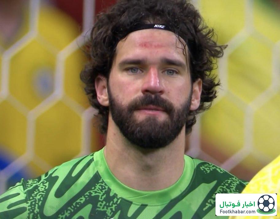 آلیسون اشک برزیل را درآورد! (عکس)