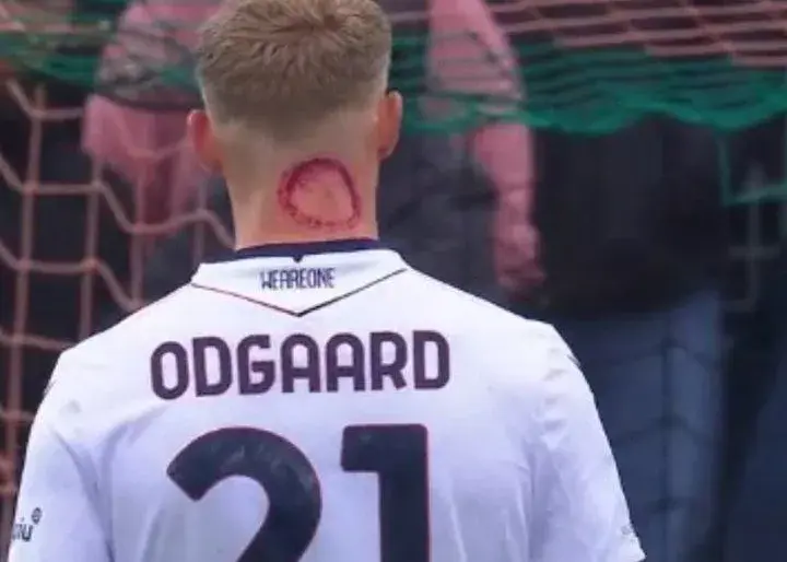 ژانر وحشت در سری آ: مهاجم دانمارکی زامبی شد (عکس)