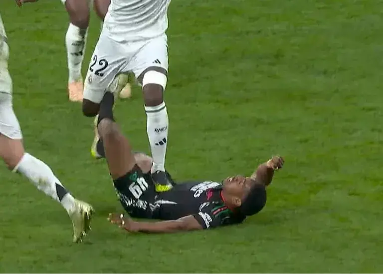 اسکلی لگد رودریگر را فراموش نمی‌کند (عکس)