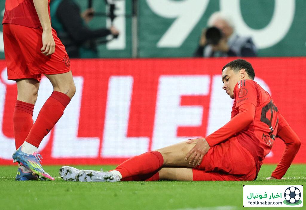 کمپانی همین را کم داشت: موسیالا مصدوم شد!