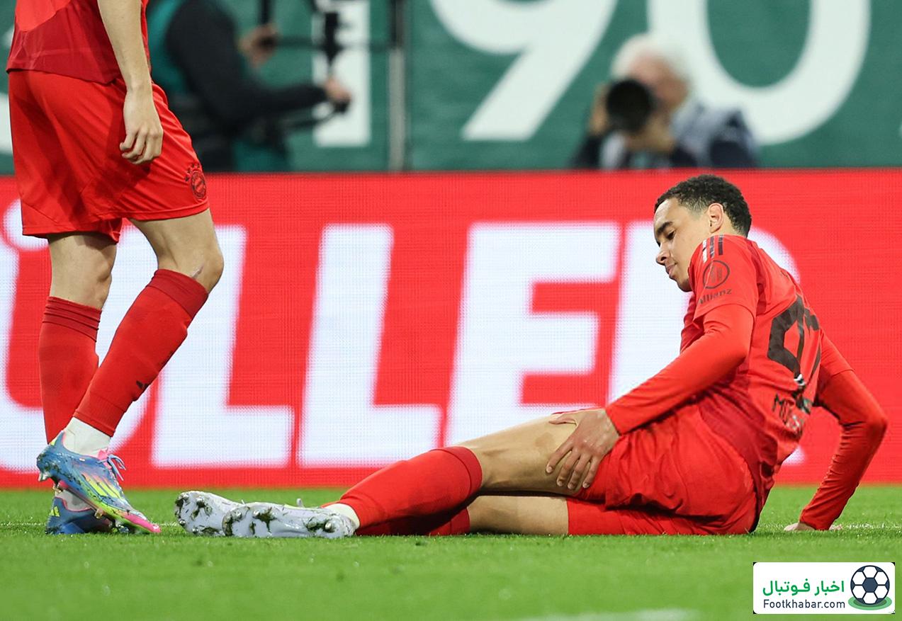 کمپانی همین را کم داشت: موسیالا مصدوم شد!