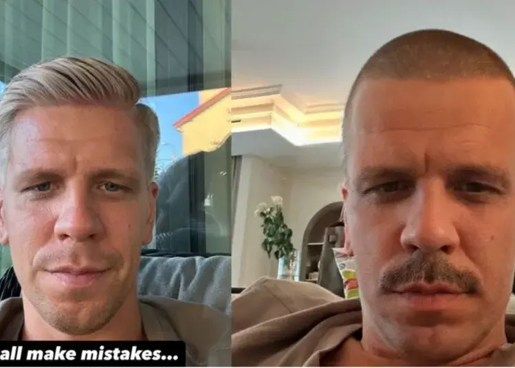 از بلوند به کچل: تصمیم شزنی به خاطر همسرش!