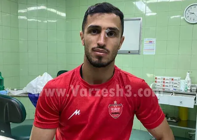 آقای گل خیلی زود برگشت/ علیپور با صورت شکافته در پرسپولیس! (عکس)