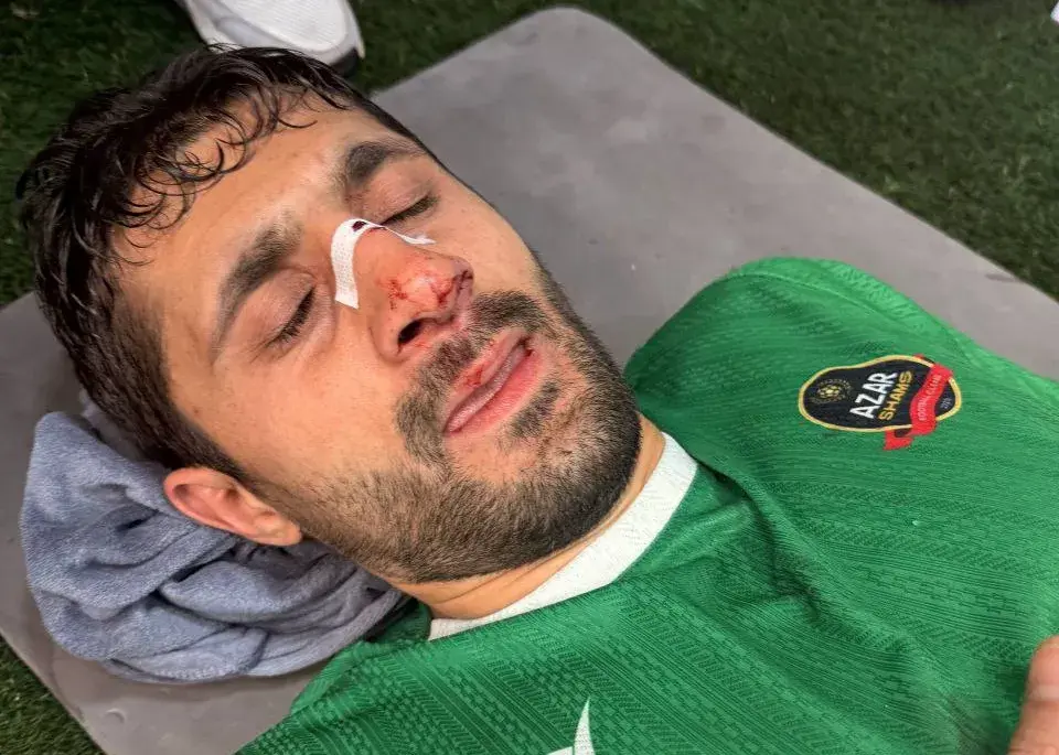 مدافع شمس آذر هم نقاب‌پوش شد (عکس)