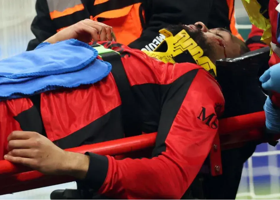 مصدومیت خطرناک لوفتوس چیک/ ستاره میلان از زمین یکراست راهی بیمارستان شد!